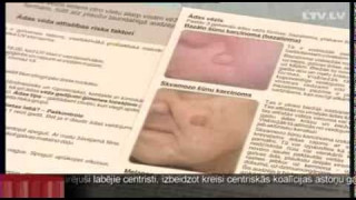 В Латвии на треть увеличилась заболеваемость раком кожи
