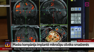 Maska kompānija implantē mikročipu cilvēka smadzenēs