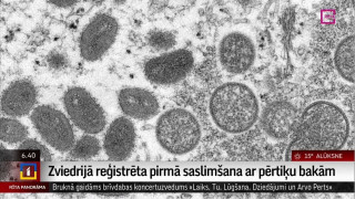 Zviedrijā reģistrēta pirmā saslimšana ar pērtiķu bakām