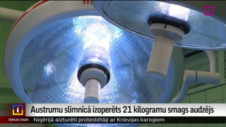 Austrumu slimnīcā izoperēts 21 kilogramu smags audzējs