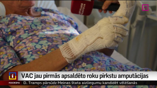 VAC jau pirmās apsaldēto roku pirkstu amputācijas