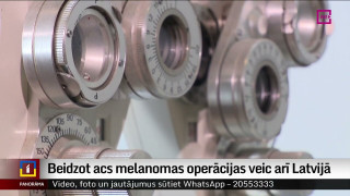 Beidzot acs melanomas operācijas veic arī Latvijā