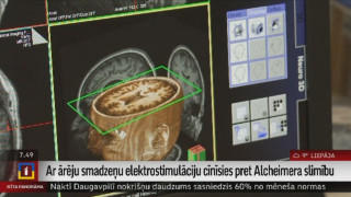 Ar ārēju smadzeņu elektrostimulāciju cīnīsies pret Alcheimera slimību