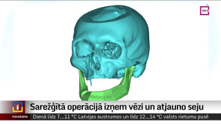 Sarežģītā operācijā izņem galvas un kakla audzēju un atjauno seju